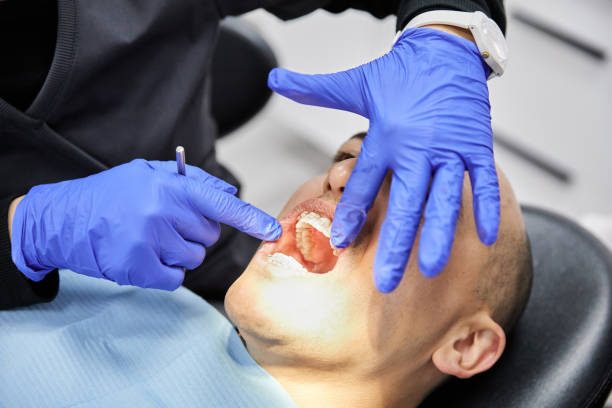 Best Urgent Tooth Repair  in Collins, MS