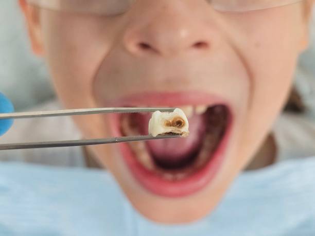 Best Urgent Dental Care  in Collins, MS